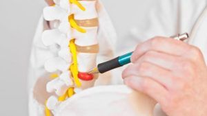 Hernia Lumbar: los 3 Tratamientos más efectivos